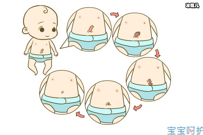 宝宝肚脐护理有哪些注意事项？新生儿肚脐流水的原因是什么？